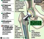 Publication info prothèses