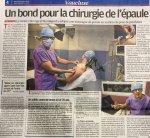 Article sur les Protheses d' Epaule 